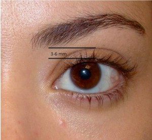 Charlotte Beautiful Eye 300x276 How Does a Charlotte Facial Cosmetic Surgeon Make the Eyes Look Better After an Upper Blepharoplasty (Eyelift)
